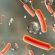 شناسایی نخستین مورد ابتلا به وبا در مازندران